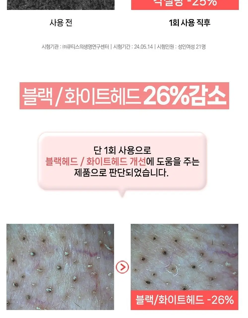[여드름기능성/약알칼리성] 아토뮤 아크리스 폼클렌저 120ml 상세페이지 24